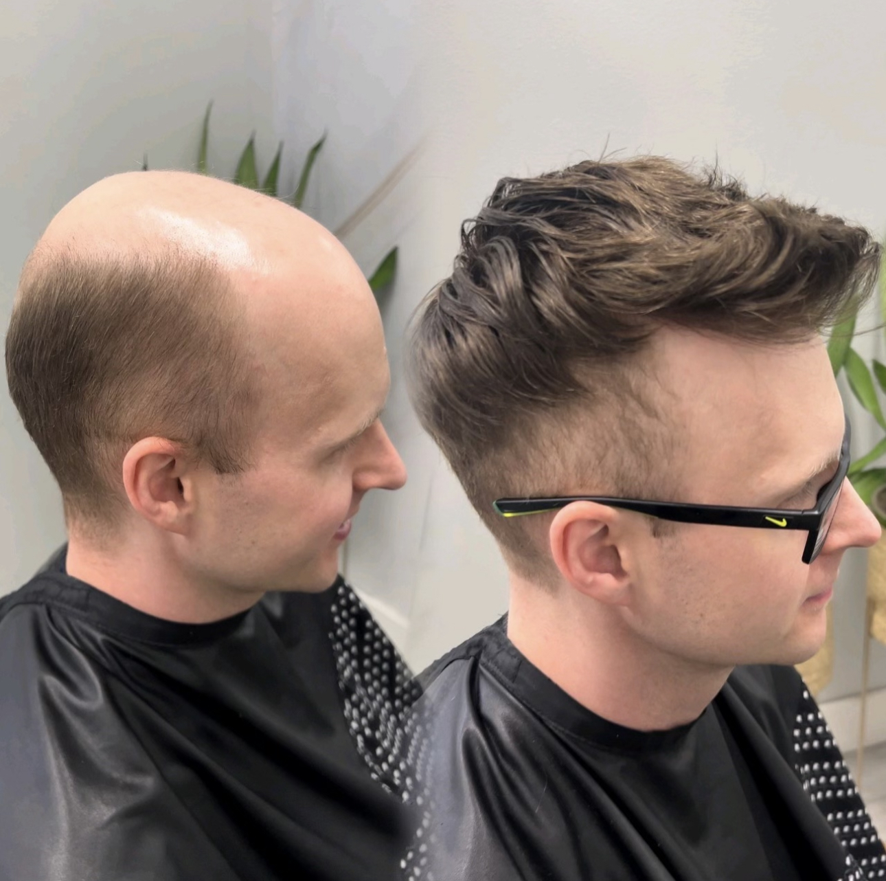 Before-and-after custom hair system result for a client in Kenosha, Wisconsin